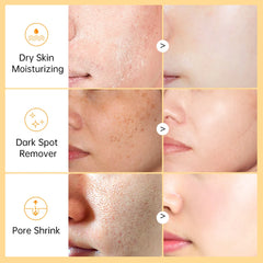 Vitamin C Face Whitening Serum Deep Moisturizing Removal Dark Spots Hyaluronic Acid Essence Anti Aging Facial Serum Skin Care