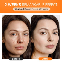 Vitamin C Face Whitening Serum Deep Moisturizing Removal Dark Spots Hyaluronic Acid Essence Anti Aging Facial Serum Skin Care